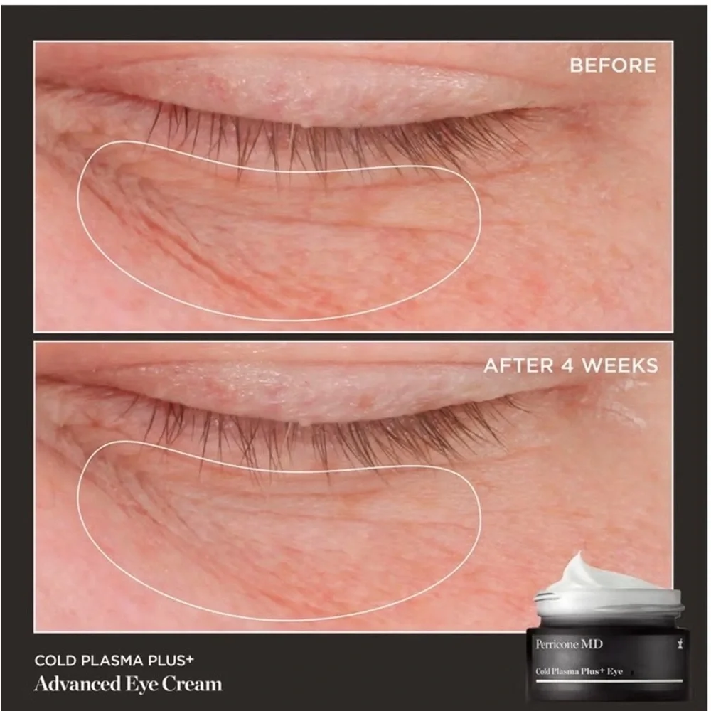 New Perricone MD Cold Plasma Plus+ Eye Cream